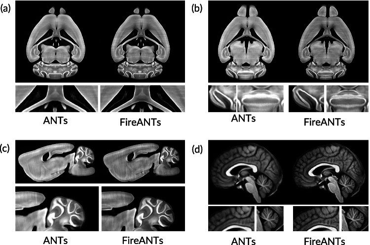 Brain templates built with ANTs left in each panel and FireANTs right , including a 25 μm fMOST mouse brain template. Figure 6 from Jena, Chaudhari Gee, Nature Communications 2026 , CC BY 4.0 https: creativecommons.org licenses by 4.0 .