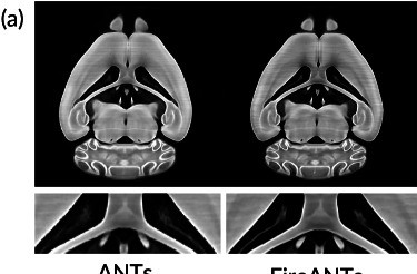 FireANTs: fast, training-free image registration on the GPU