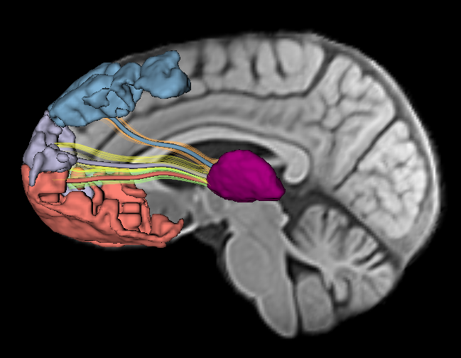 Traumatic Brain Injury
