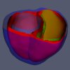 Cardiac Medial Modeling