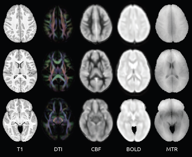 Relating Cerebral Blood Flow to Structural Functional Metrics in Typically Developing Children