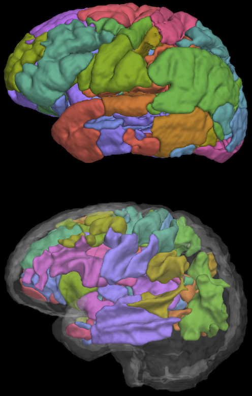 Relating brain anatomy and cognitive ability using a multivariate multimodal framework