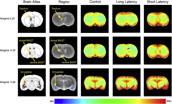 Manganese-enhanced magnetic resonance imaging MEMRI in rats with a history of repeated social stress.