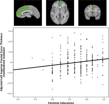 Associations between children s socioeconomic status and prefrontal cortical thickness