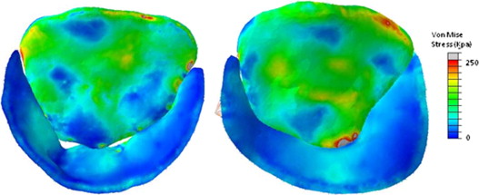 Prediction of stress distributions on image-derived models of the mitral leaflets