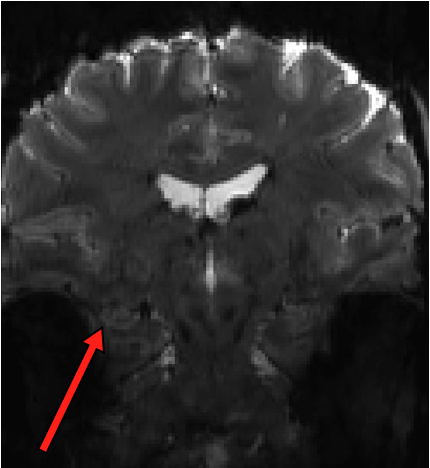 7T fMRI R03 grant