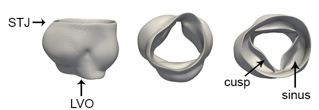Segmentation of the aortic leaflets in 3D echocardiographic images