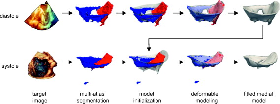 Fully automated segmentation of the mitral leaflets using multi-atlas label fusion and deformable medial modeling