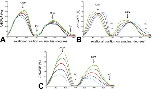 normal annular shape modes normal annular shape modes
