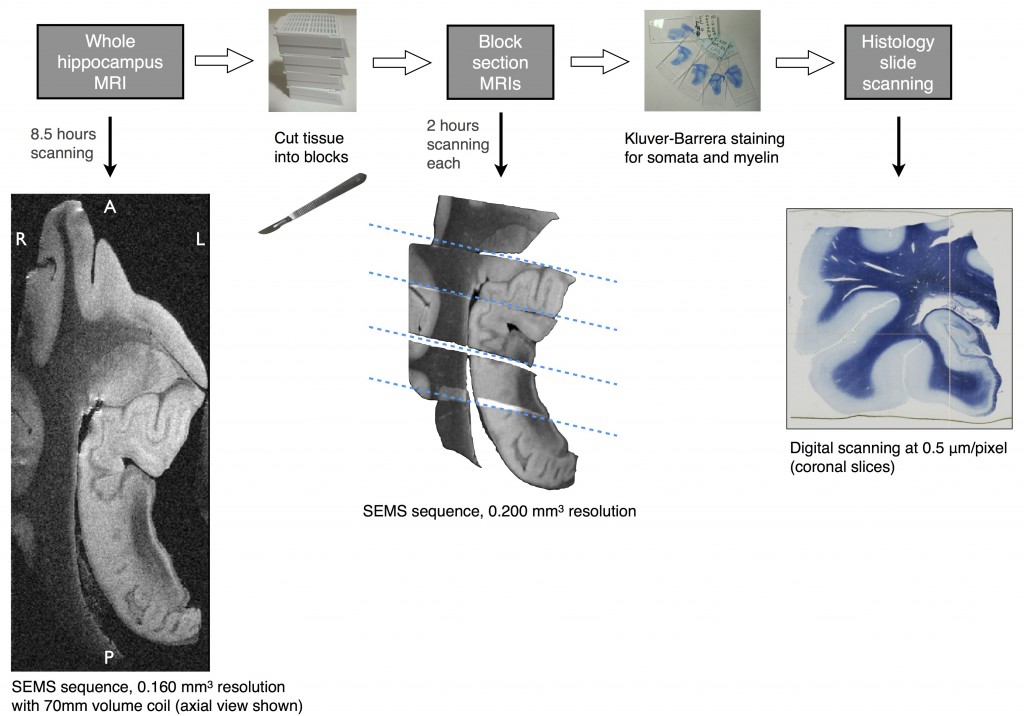 Postmortem MR and histological imaging protocol of the human hippocampal formation