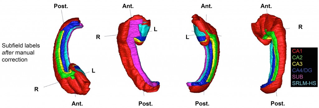Postmortem, probabilistic atlas of the human hippocampal formation
