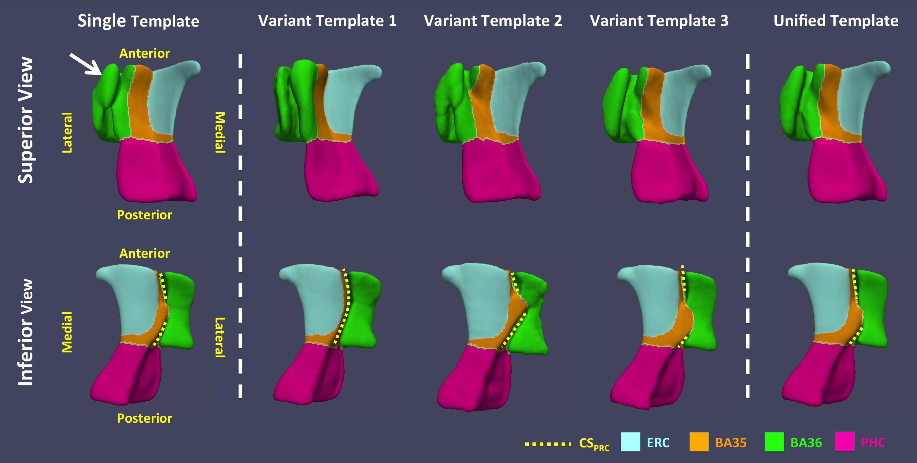 Multi-Template Analysis of Human Perirhinal Cortex in Brain MRI: Explicitly Accounting for Anatomical Variability