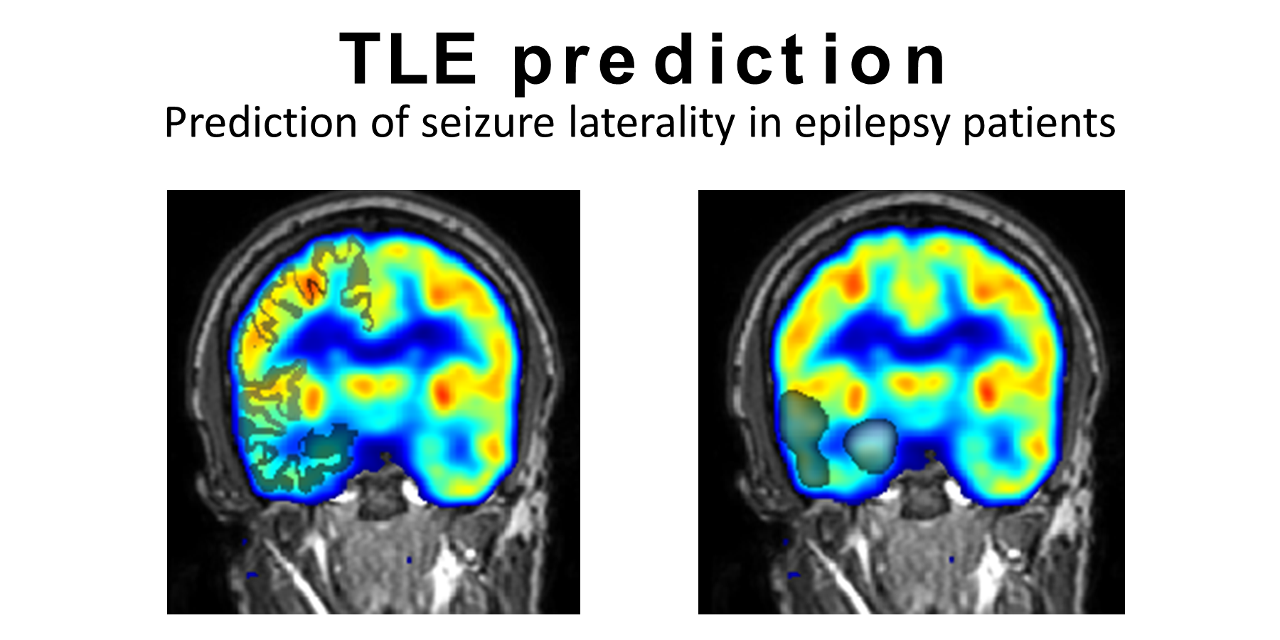 TLEprediction